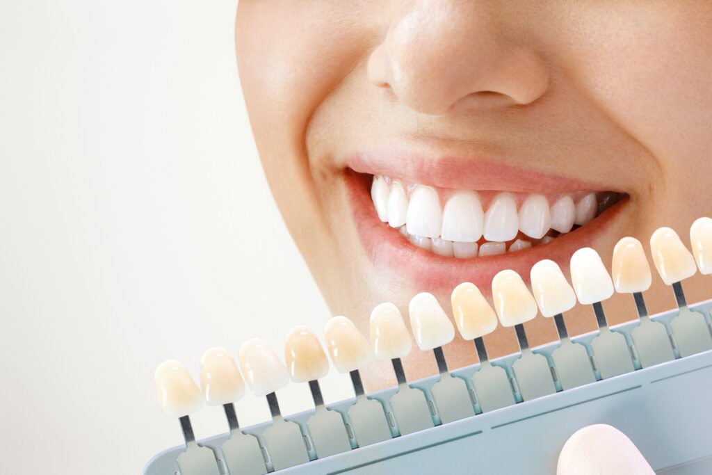 Closeup of someone smiling with a shade guide held to their teeth